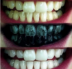 Dontodent Black Shine Toothpaste - 75ml